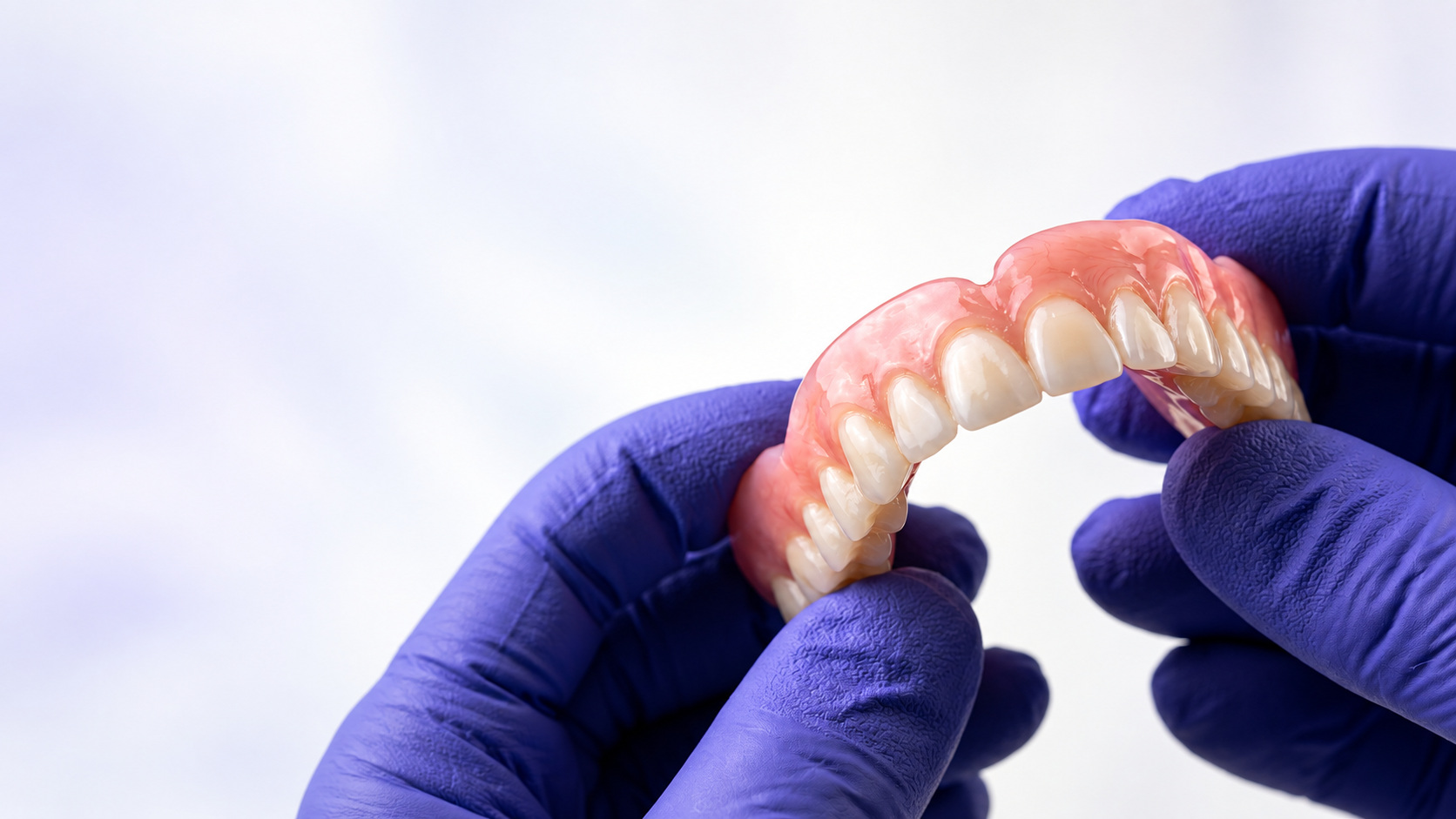 Manos con guantes violetas sosteniendo una prótesis dental removible